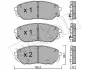 Комплект гальмівних колодок (дискових) Metelli 22-1096-0 (фото 1)