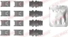 Планка супорта (переднього) прижимна MB A-class (W177)/B-class (W247) 18- (к-кт) QUICK BRAKE 109-0110 (фото 1)